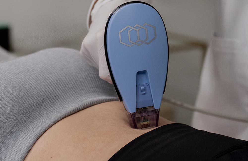 laser-therapy-hair-removal-anti-aging-skincare-brookfield-wi_healthy-skincare-anti-aging-treatments-medical-spa-brookfie laser-therapy-hair-removal-anti-aging-skincare-brookfield-wi_healthy-skincare-anti-aging-treatments-medical-spa-brookfie