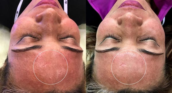 med-spa_celluma-led-light-therapy-anti-aging-skin-care-brookfield-wi3 med-spa_celluma-led-light-therapy-anti-aging-skin-care-brookfield-wi3