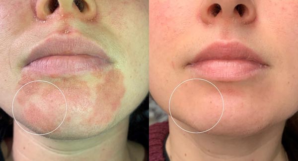 med-spa_celluma-led-light-therapy-anti-aging-skin-care-brookfield-wi4 med-spa_celluma-led-light-therapy-anti-aging-skin-care-brookfield-wi4